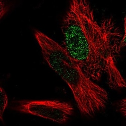 MED31 Antibody, Novus Biologicals 25 &mu;L; Unlabeled:Antibodies, Polyclonal
